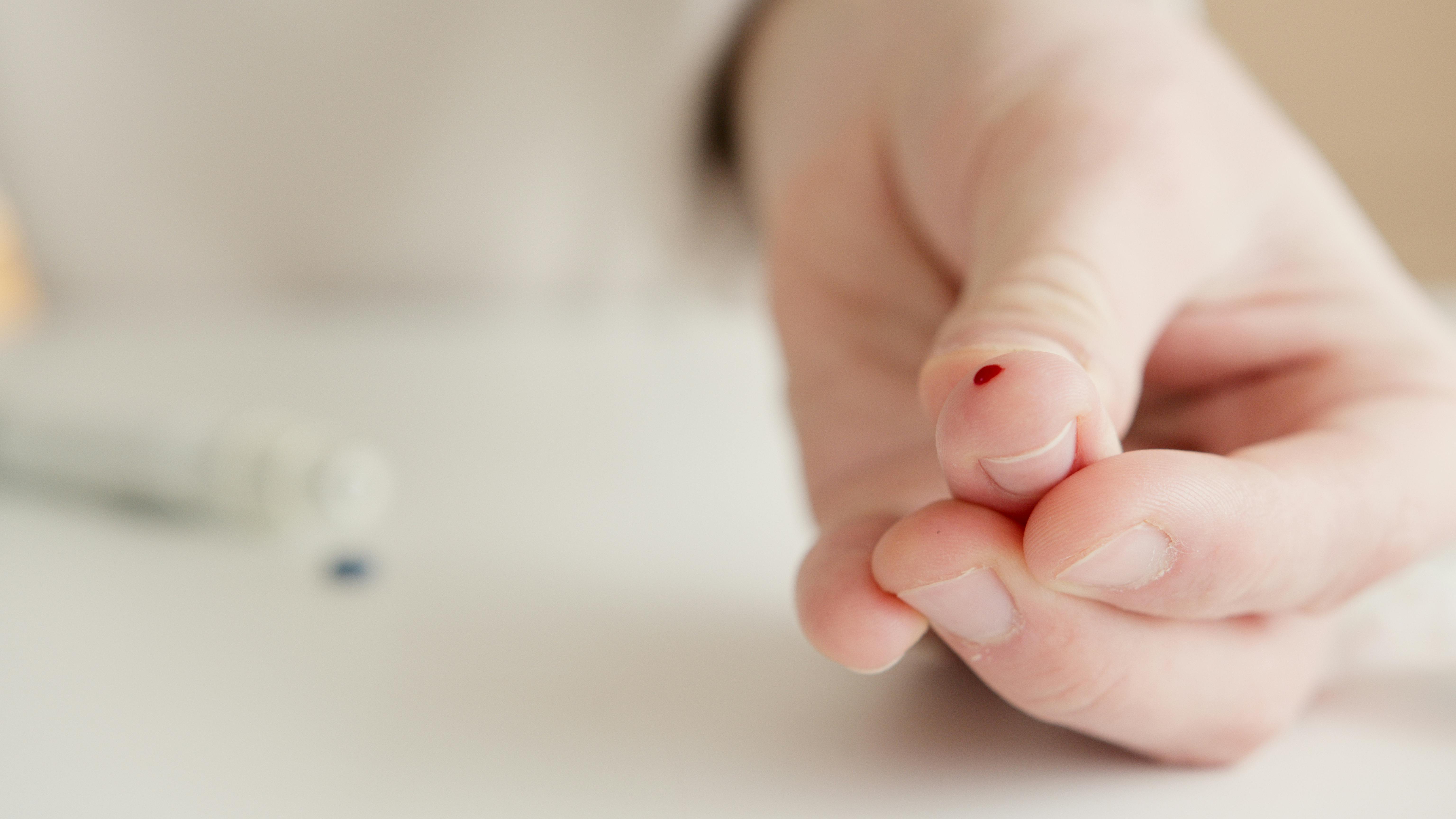 Diabetes, prevención y tratamientos